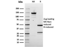 SDS-PAGE Analysis Purified Napsin A Mouse Monoclonal Antibody (rNAPSA/1239). (Recombinant NAPSA 抗体  (AA 189-299))
