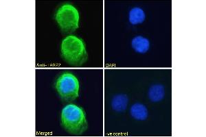ABIN190867 Immunofluorescence analysis of paraformaldehyde fixed A431 cells, permeabilized with 0. (LARP1B 抗体  (Internal Region))