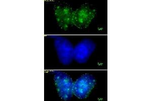 Histone H3 trimethyl Lys9 mAb (Clone 2AG-6F12-H4) tested by immunofluorescence. (Histone 3 抗体  (H3K9me3))