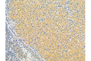 ABIN7093191 and ABIN7097196 at 1/100 staining Rat ovary tissue by IHC-P. (ERLIN2 抗体  (C-Term))