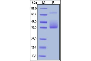 SDS-PAGE (SDS) image for Colony Stimulating Factor 1 (Macrophage) (CSF1) (AA 33-255) (Active) protein (His tag,AVI tag,Biotin) (ABIN6386447)
