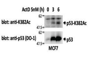 Western Blotting (WB) image for anti-Tumor Protein P53 (TP53) antibody (ABIN1449253) (p53 抗体)