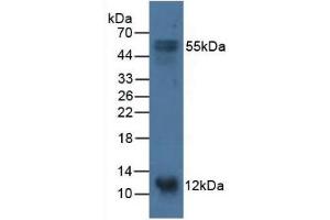 Detection of S100A14 in Porcine Stomach Tissue using Polyclonal Antibody to S100 Calcium Binding Protein A14 (S100A14) (S100A14 抗体  (AA 1-91))