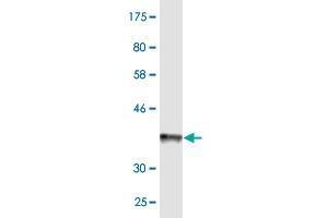 Western Blotting (WB) image for anti-ATP-Binding Cassette, Sub-Family B (MDR/TAP), Member 6 (ABCB6) (AA 743-842) antibody (ABIN523433)