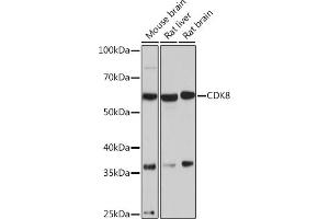 Western blot analysis of extracts of various cell lines, using CDK8 Rabbit mAb (ABIN7266596) at 1:1000 dilution. (CDK8 抗体)