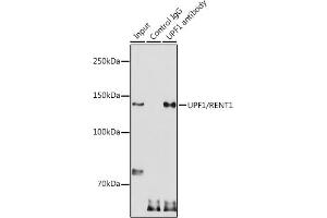 Immunoprecipitation analysis of 300 μg extracts of HeLa cells using 3 μg UPF1/RENT1 antibody (ABIN3022068, ABIN3022069, ABIN3022070 and ABIN6218593). (RENT1/UPF1 抗体  (AA 270-370))