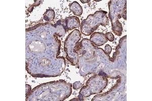 Immunohistochemical staining of human placenta with PTCD2 polyclonal antibody  shows strong cytoplasmic positivity in trophoblastic cells. (PTCD2 抗体)