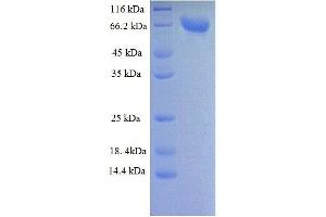 SDS-PAGE (SDS) image for Dipeptidyl-Peptidase 6 (DPP6) (AA 111-859) protein (His tag) (ABIN7479045)
