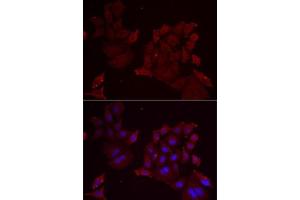 Immunofluorescence analysis of MCF7 cells using Pannexin 1 antibody (ABIN6128523, ABIN6145204, ABIN6145206 and ABIN6217644). (PANX1 抗体  (AA 297-426))