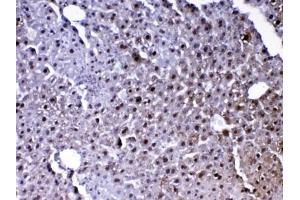 IHC testing of FFPE mouse liver tissue with Park7 antibody at 1ug/ml. (PARK7/DJ1 抗体)