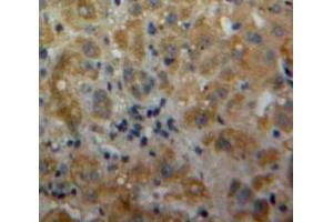 IHC-P analysis of Liver tissue, with DAB staining. (IL-17 抗体  (AA 20-155))