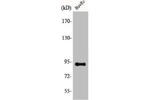 Western Blot analysis of COLO205 cells using AKAP 149 Polyclonal Antibody