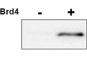Image no. 1 for anti-Cyclin-Dependent Kinase 9 (CDK9) (pThr29) antibody (ABIN401390) (CDK9 抗体  (pThr29))