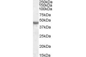 Image no. 1 for anti-Potassium Inwardly-Rectifying Channel, Subfamily J, Member 1 (KCNJ1) (AA 245-259) antibody (ABIN490492) (KCNJ1 抗体  (AA 245-259))