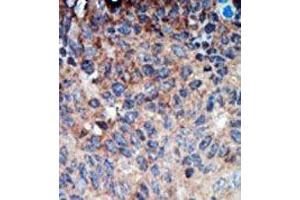 Image no. 2 for anti-Non-Metastatic Cells 1, Protein (NM23A) Expressed in (NME1) (N-Term) antibody (ABIN360544) (NME1 抗体  (N-Term))
