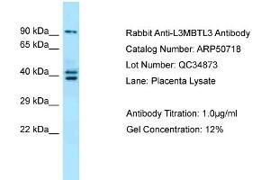 WB Suggested Anti-L3MBTL3 Antibody Titration:  0. (L3MBTL3 抗体  (N-Term))