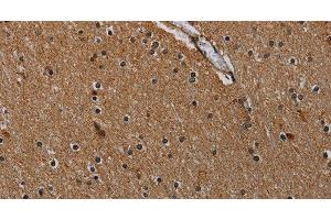 Immunohistochemistry of paraffin-embedded Human brain using IVL Polyclonal Antibody at dilution of 1:50 (Involucrin 抗体)