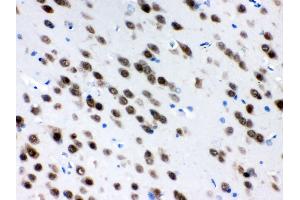 Anti- ELAVL4 Picoband antibody, IHC(P) IHC(P): Rat Brain Tissue (ELAVL4 抗体  (N-Term))