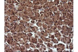 Image no. 5 for anti-Tripartite Motif Containing 44 (TRIM44) antibody (ABIN1501505)