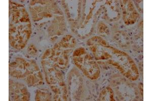 IHC image of ABIN7127384 diluted at 1:100 and staining in paraffin-embedded human kidney tissue performed on a Leica BondTM system. (Recombinant Caspase 2 抗体)