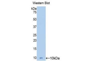 Western Blotting (WB) image for anti-Mucin 5 Subtype B (MUC5B) (AA 5366-5444) antibody (ABIN1078357) (MUC5B 抗体  (AA 5366-5444))