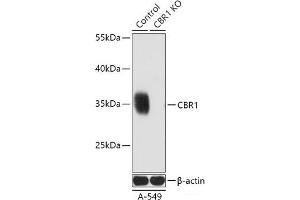 Western blot analysis of extracts from normal (control) and CBR1 knockout (KO) A-549 cells using CBR1 Polyclonal Antibody at dilution of 1:3000. (CBR1 抗体)