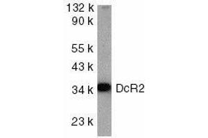 Western blot analysis of DcR2 in HeLa cell lysate with DcR2 antibody at 1ug/ml. (DcR2 抗体)