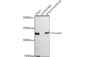 Immunoprecipitation analysis of 300 μg extracts of HeLa cells using 3 μg Vinculin antibody (ABIN3016604, ABIN3016605, ABIN1680530 and ABIN1680531). (Vinculin 抗体)