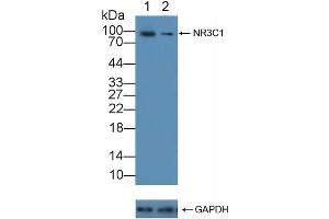 Western Blotting (WB) image for anti-Nuclear Receptor Subfamily 3, Group C, Member 1 (Glucocorticoid Receptor) (NR3C1) antibody (ABIN7643723)