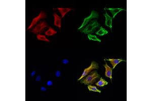 ABIN6265100 and ABIN6272929 staining Hela cells by IF/ICC.
