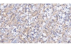 Detection of WTAP in Human Stomach Tissue using Polyclonal Antibody to Wilms Tumor 1 Associated Protein (WTAP) (WTAP 抗体  (AA 1-150))