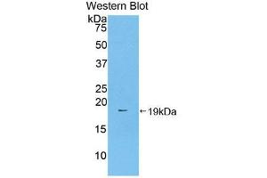 Western blot analysis of the recombinant protein. (Prothrombin 抗体  (AA 44-200))