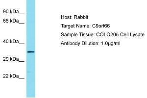 Host: Rabbit Target Name: C9ORF66 Sample Tissue: Human COLO205 Whole Cell Antibody Dilution: 1ug/ml (C9ORF66 抗体  (C-Term))