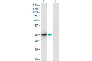 Western Blot analysis of DC-UbP expression in transfected 293T cell line by DC-UbP monoclonal antibody (M01), clone 1B8-1B1. (UBTD2 抗体  (AA 1-190))