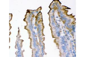 IHC analysis of Plectin using anti-Plectin antibody (ABIN3043900).