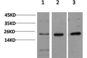Western Blotting (WB) image for anti-Chromobox Homolog 5 (CBX5) antibody (ABIN5957538) (CBX5 抗体)