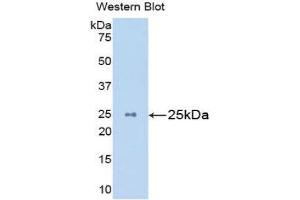 Western Blotting (WB) image for anti-Mannan-Binding Lectin serine Peptidase 2 (MASP2) (AA 22-142) antibody (ABIN1859765) (MASP2 抗体  (AA 22-142))