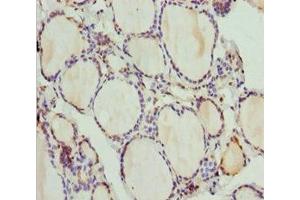 Immunohistochemistry of paraffin-embedded human thyroid tissue using ABIN7163635 at dilution of 1:100 (PLEKHA1 抗体  (AA 285-404))