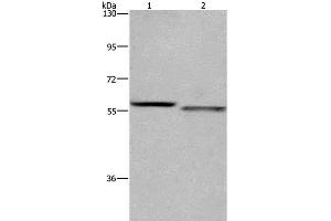 Western Blot analysis of K562 and A431 cell using FRK Polyclonal Antibody at dilution of 1:1200 (FRK 抗体)