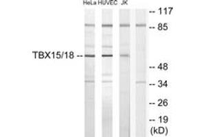 Western blot analysis of extracts from HuvEc/HeLa/Jurkat cells, using TBX15/18 Antibody. (T-Box 15/18 抗体  (AA 161-210))