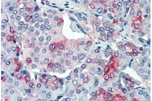 Anti-SLC11A2 antibody  ABIN1049329 IHC staining of human, pancreas. (SLC11A2 抗体  (Internal Region))