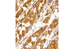 Immunohistochemical analysis of paraffin-embedded H. (MORC3 抗体  (AA 634-663))