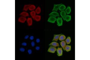 TXNDC6 Antibody staining Hela cells(45 min of heat-shock treatment) by IF/ICC.