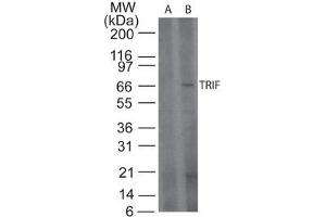 TRIF Western Blot. (TICAM1 抗体)
