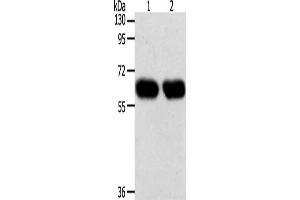 Gel: 10 % SDS-PAGE, Lysate: 40 μg, Lane 1-2: Lncap cells, SKOV3 cells, Primary antibody: ABIN7131276(SYT7 Antibody) at dilution 1/200, Secondary antibody: Goat anti rabbit IgG at 1/8000 dilution, Exposure time: 1 minute (SYT7 抗体)