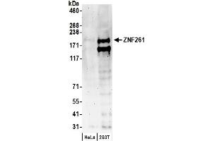 Western Blotting (WB) image for anti-Zinc Finger Protein 261 (ZMYM3) (AA 250-300) antibody (ABIN7449408) (ZMYM3 抗体  (AA 250-300))