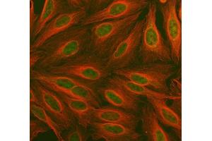 IF analysis of PDK2 using anti-PDK2 antibody (ABIN5693279) and anti-Tubulin Alpha antibody (ABIN7600339).