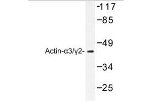Image no. 1 for anti-Actin, gamma 2, Smooth Muscle, Enteric (ACTG2) antibody (ABIN265300) (ACTG2 抗体)