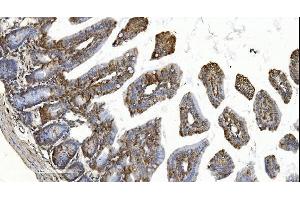 IHC analysis of YTHDF2 using anti-YTHDF2 antibody (ABIN7603191). (YTHDF2 抗体  (N-Term))