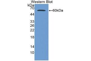 Western blot analysis of the recombinant protein. (Glucose-6-Phosphate Dehydrogenase 抗体  (AA 1-515))